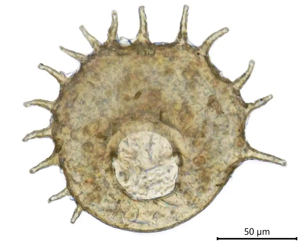 Centropyxis spinosa